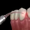Dental-Laser-Course