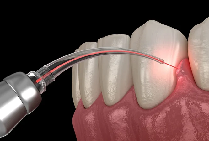 Dental-Laser-Course