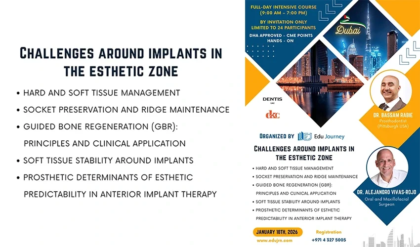 Challenges-around-implants-in-the-esthetic-zone-Cover-850x500