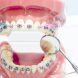 Orthodontist in Spring