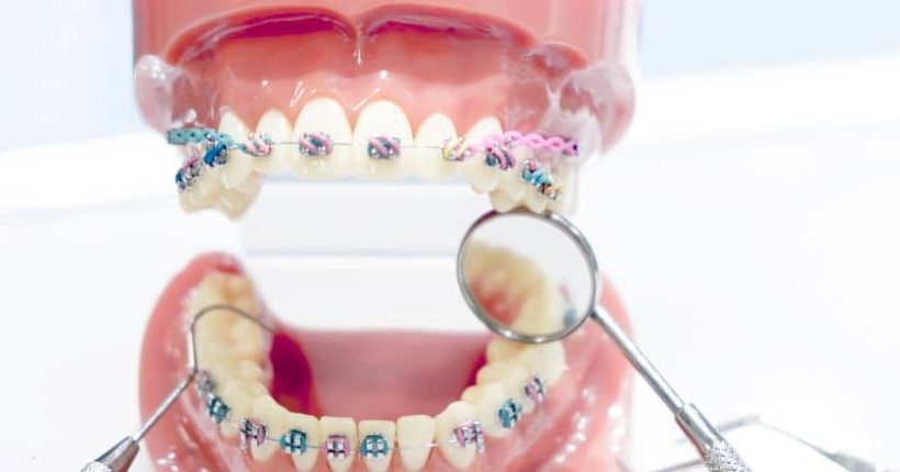 Orthodontist in Spring